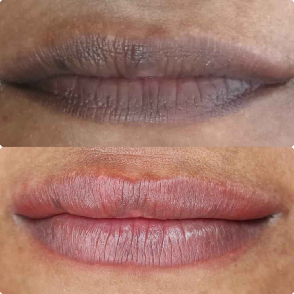permanent lip makeup