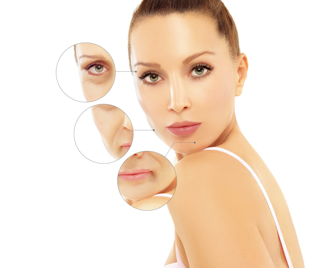 Skin Tightening Treatment