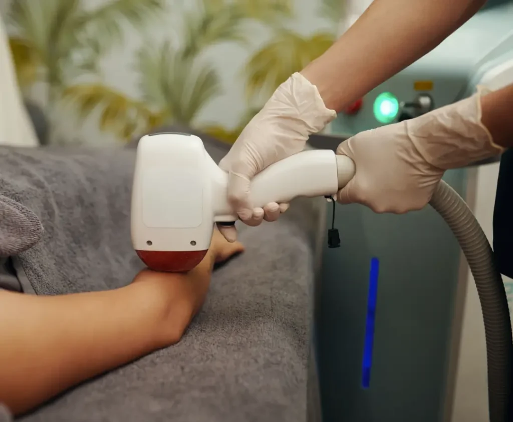 Laser hair removal in wakad